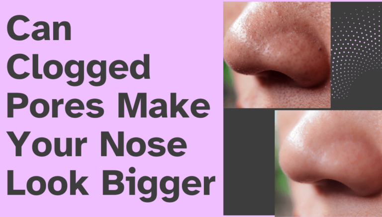 Can Clogged Pores Make Your Nose Look Bigger