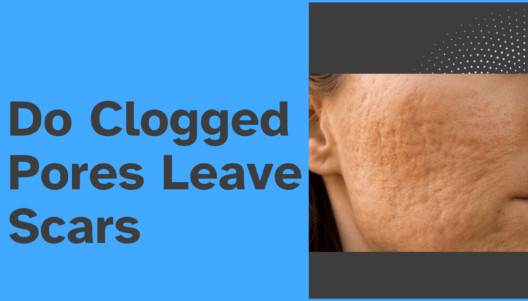 Do Clogged Pores Leave Scars